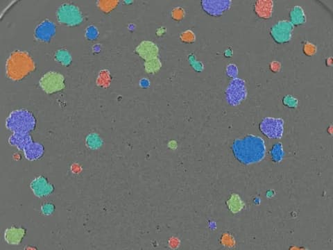 Phase-contrast image of lung cancer cells grown as many spheroids, each filled with a color where the analysis outlined it, touching spheroids sharing one color.