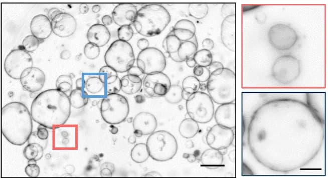 Brightfield overview of many round mouse pancreas organoids, each with one large lumen, with two boxed organoids enlarged at right.
