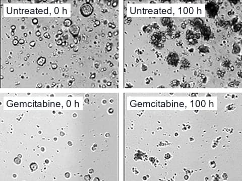 Live-imaging pictures of mouse pancreatic cancer organoids, untreated and given 1000 nM gemcitabine, at 0 and 100 hours, where the treated well holds fewer organoids and more debris.