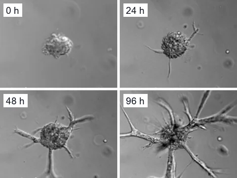 Differential interference contrast time-lapse images of one neuroblastoma organoid from a patient-derived xenograft at 0, 24, 48 and 96 hours, as it sends branching strands into the gel.