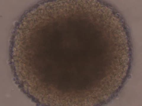 Phase-contrast image of one round, untreated neurosphere of human neural stem cells, after a wash.