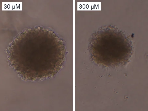 Phase-contrast images of two neurospheres of human neural stem cells after 30 and 300 µM etoposide and a wash, each with a rough, uneven edge.
