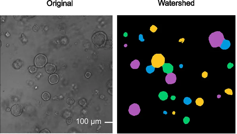 Left, a microscope image of round organoids, some touching. Right, the same field with each organoid filled in its own color, the touching ones included.