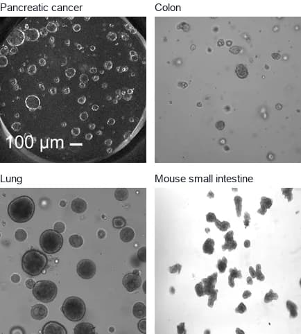 Microscope images of organoids grown from four tissues, labeled pancreatic cancer, colon, lung and mouse small intestine.