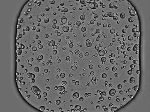 Brightfield image of most of one well of a 384-well plate, crowded with cystic patient-derived organoids of many sizes.