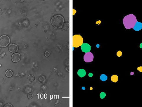A microscope image of organoids, some of them touching, beside the same field with each organoid filled in its own color by OrganoID, a published tool, the touching ones included.