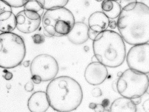 Brightfield image of mouse pancreas organoids, each with one large lumen, averaged from ten focal planes taken at 1.29 µm per pixel.