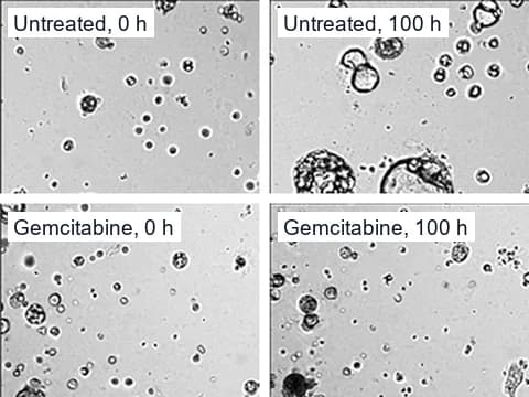 Live-imaging pictures of human pancreatic cancer organoids, untreated and given 1000 nM gemcitabine, at 0 and 100 hours, where the treated well holds fewer organoids and more debris.