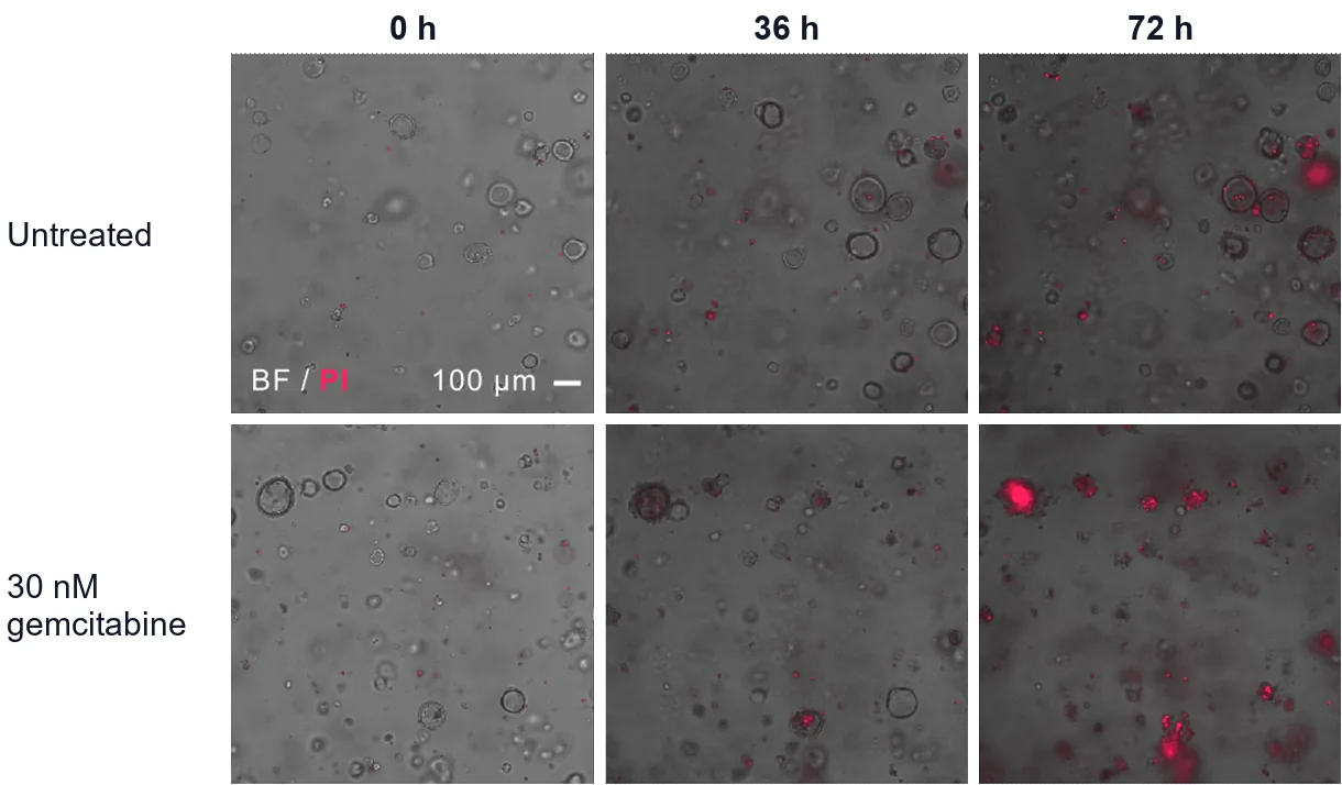 Brightfield images of pancreatic cancer organoids at 0, 36 and 72 hours, untreated in the top row and given 30 nM gemcitabine in the bottom row, where red staining spreads by 72 hours.