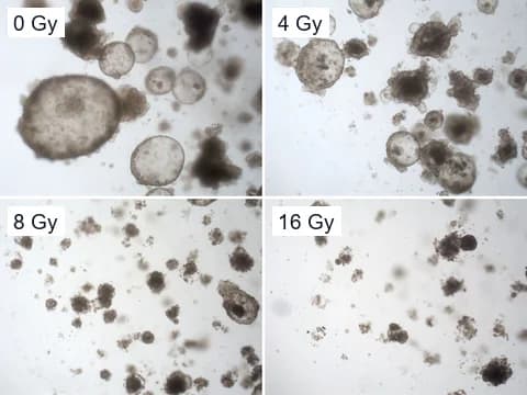 Brightfield images of rectal cancer organoids from one line on day 15 after 0, 4, 8 and 16 Gy of X-rays, smaller and more scattered at the higher doses.