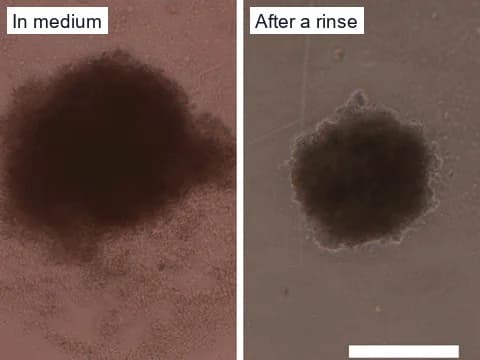 Phase-contrast images of a medulloblastoma spheroid exposed to 300 µM etoposide, ringed by a halo of debris in its medium, and the same spheroid after a rinse.