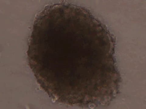 Phase-contrast image of a medulloblastoma spheroid exposed to 30 µM etoposide and then rinsed, darker at its center than at its edge.