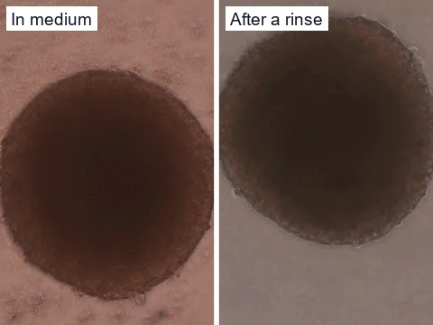 Phase-contrast images of one untreated medulloblastoma spheroid in its pinkish culture medium and after a rinse in buffer, when the background turns grey.