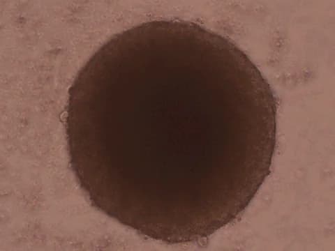Phase-contrast image of one round, dense spheroid filling most of the frame, on a pinkish background with small scattered particles.
