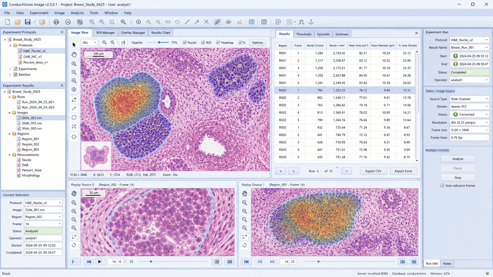 ConductVision pathology image analysis software interface with H&E slide overlays and results table