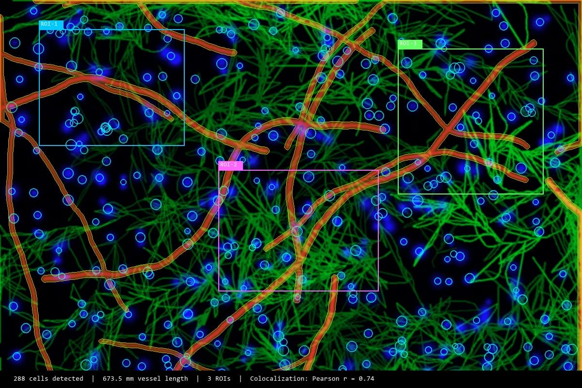 AI analysis: cell detection, vessel segmentation, ROI quantification on multi-channel fluorescence