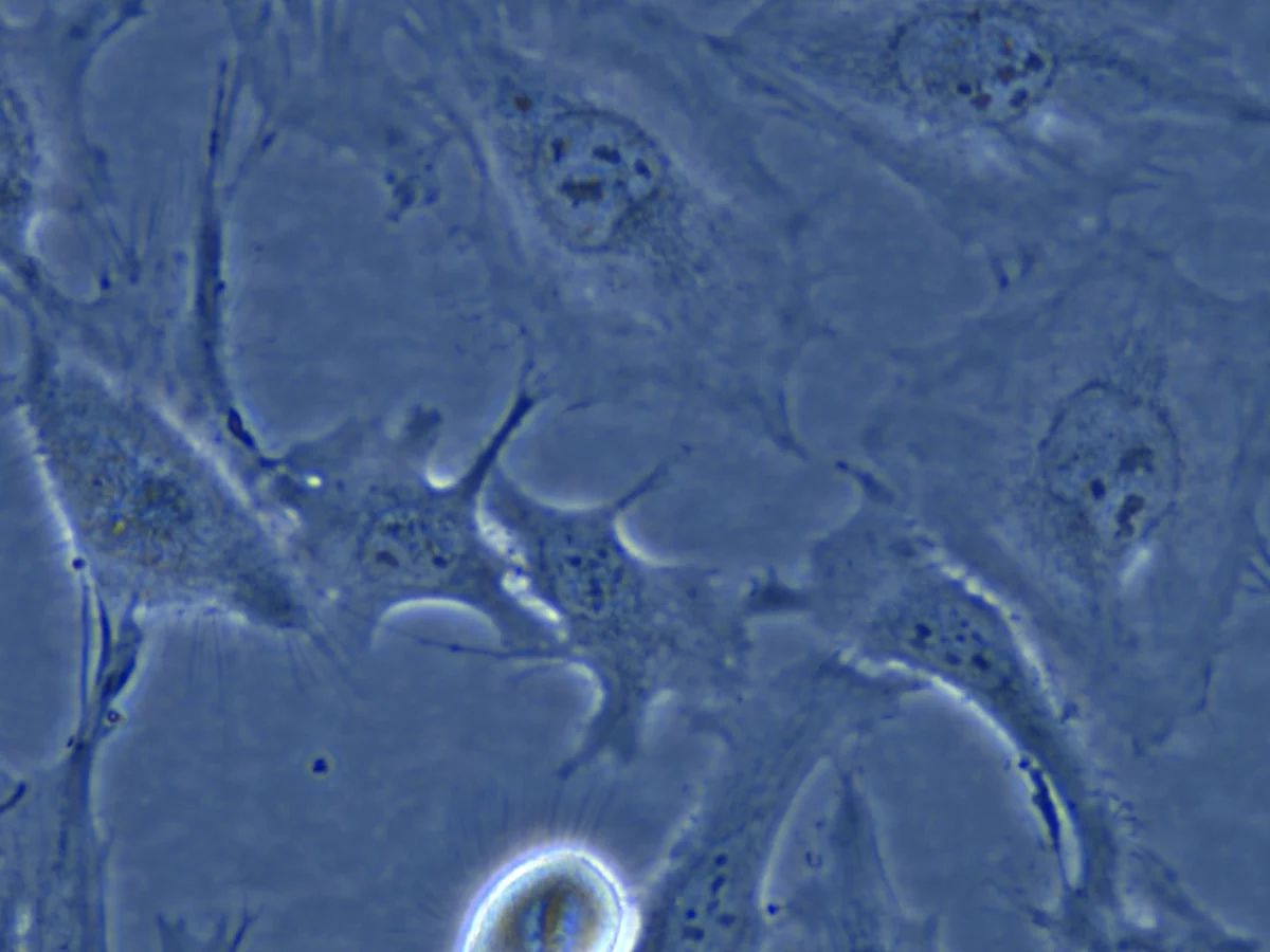 Phase-contrast micrograph of living cultured cells showing the bright halos and grayscale relief characteristic of phase optics, one of the microscopy types the engine supports.