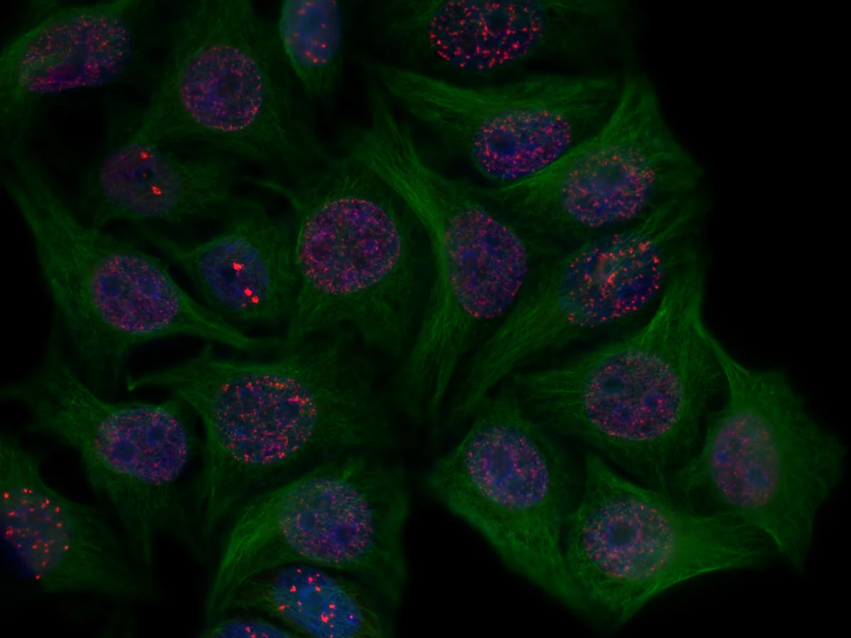 Immunofluorescence micrograph: red DNA-damage (53BP1) foci as discrete puncta inside blue-stained cell nuclei, with the green tubulin cytoskeleton around them.