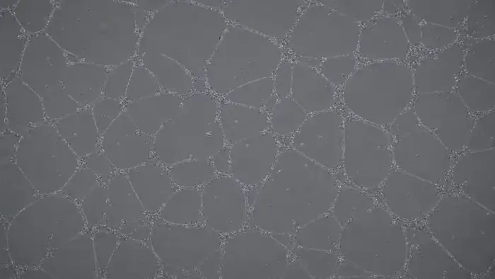 Microscopy field with branching tube-formation network