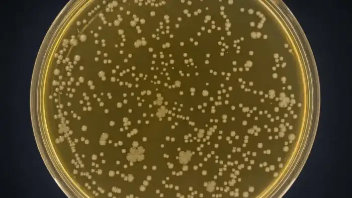 Agar plate scan with countable colonies