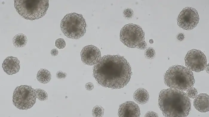 Brightfield 3D culture spheroids for morphology measurement