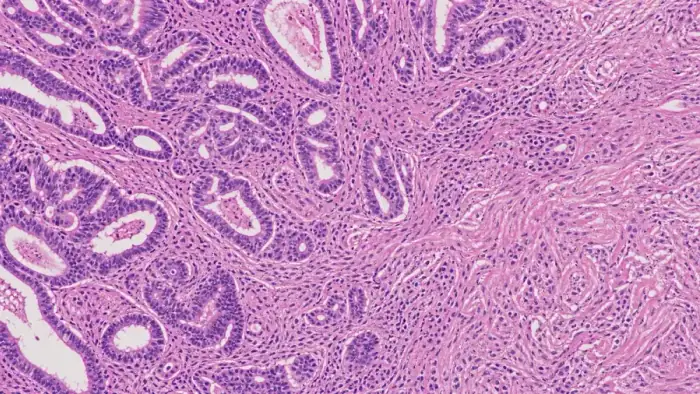 H and E-style histology field for tissue region analysis