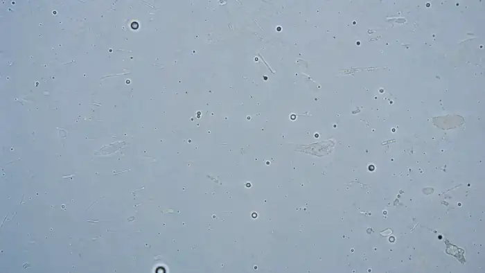 Polymer membrane surface with pinholes and film defects