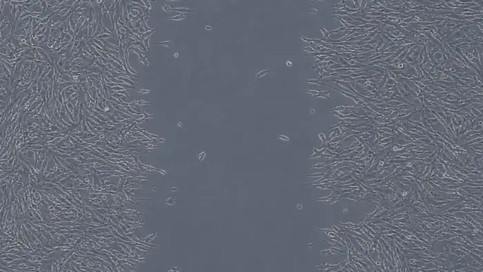 Cell monolayer scratch assay with a central migration gap