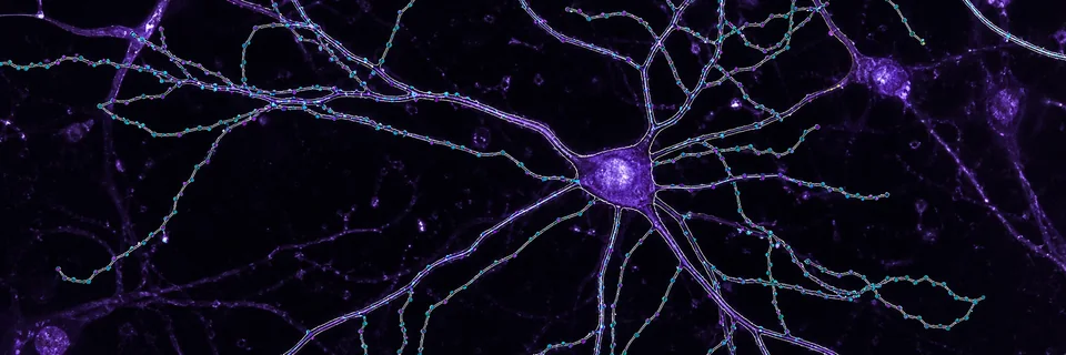ConductVision morphology tracing and morphometry workflow