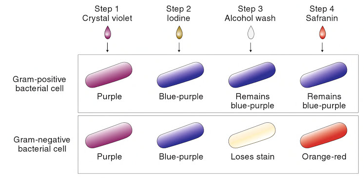 Gram staining procedure can often lead to equivocal results