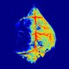 RFLSI Pro Laser Speckle Perfusion Imager - Image 3