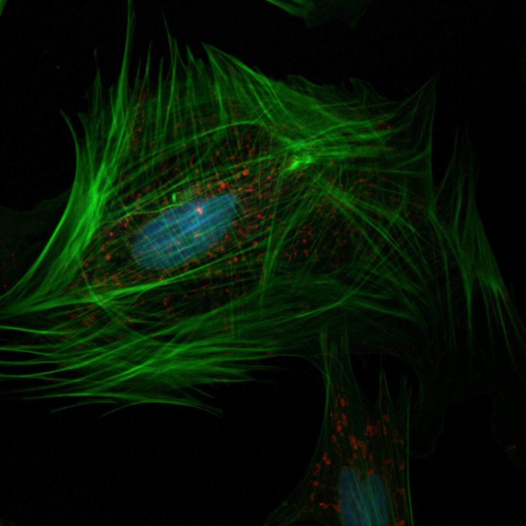 Gene Interactions