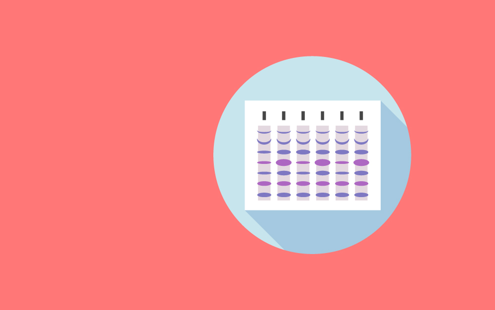 SDS-Polyacrylamide Gel Electrophoresis at Neutral pH (NuPAGE)