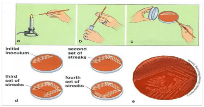 Streak plate technique illustration