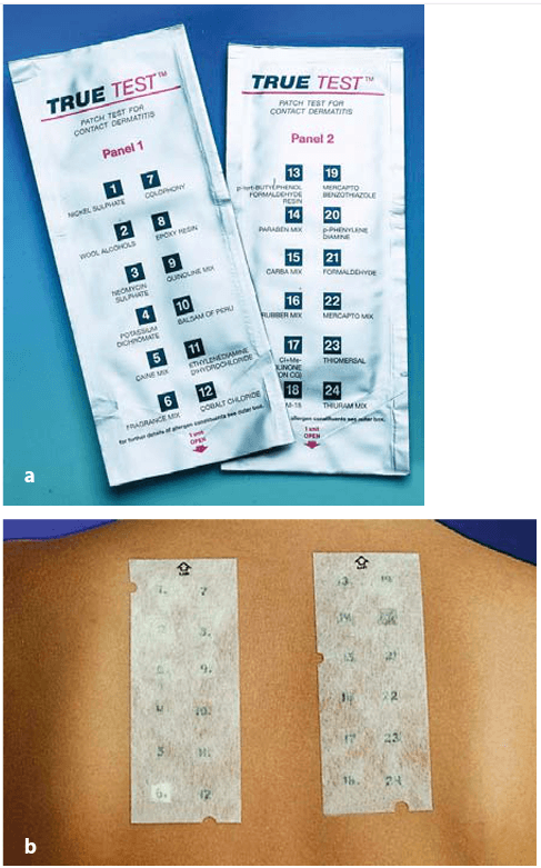 Ready-to-use visual patch test package