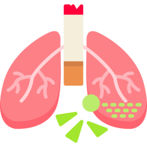 Respiration Monitoring System