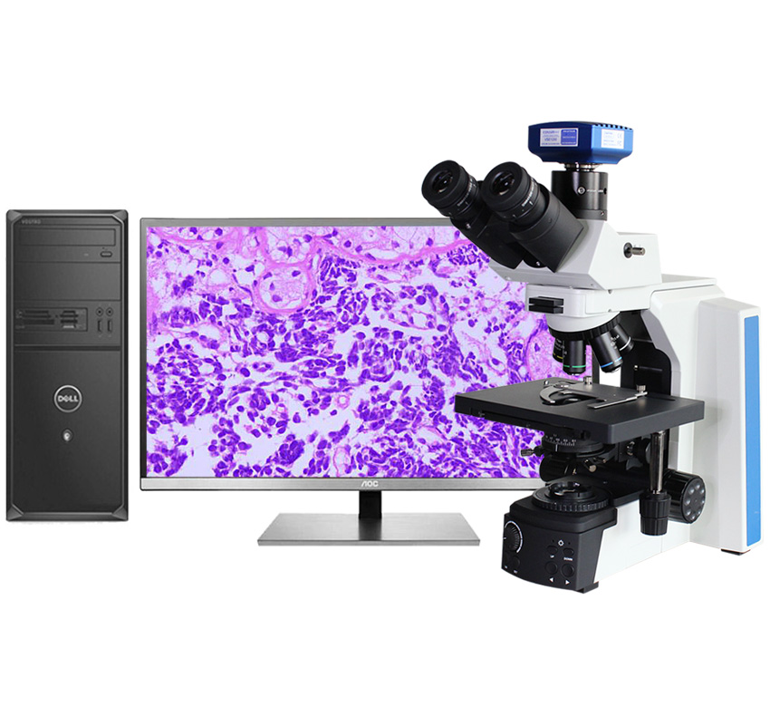 Professional Integrated Coding Nosepiece Upright Trinocular Biological Microscope for Medical Operation & Teaching