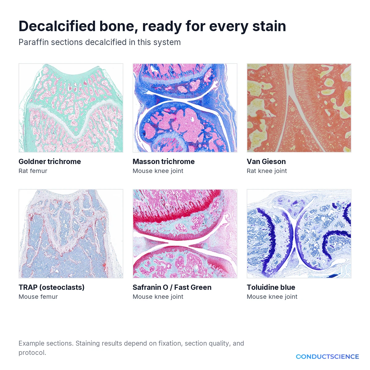 Six stains on decalcified bone sections: Goldner, Masson, Van Gieson, TRAP, Safranin O, and toluidine blue