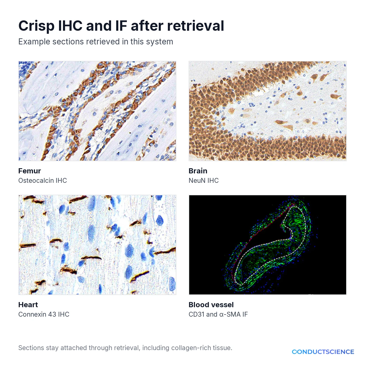 IHC of femur, brain, and heart and immunofluorescence of a blood vessel after retrieval